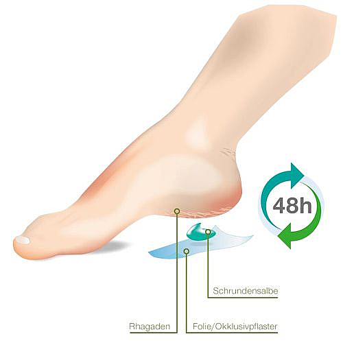 ���� 10 ������� ���� ������ OKKLUSIV PLASTER